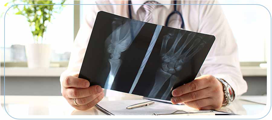 What are the Benefits of Having an X-ray at Urgent Care Near Me in Bixby Knolls, Downtown Long Beach, and Paramount, CA What are the Benefits of Having an X-ray at Urgent Care Near Me in Bixby Knolls, Downtown Long Beach, and Paramount, CA