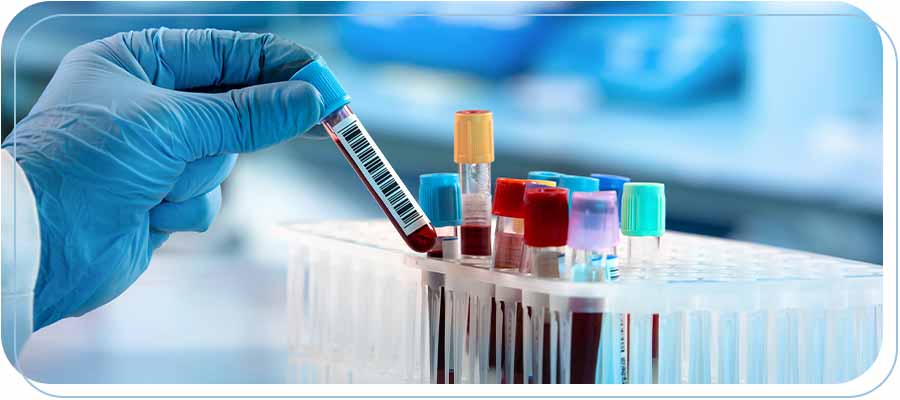 Laboratory Services in Bixby Knolls, Downtown Long Beach, and Paramount, CA Laboratory Services in Bixby Knolls, Downtown Long Beach, and Paramount, CA