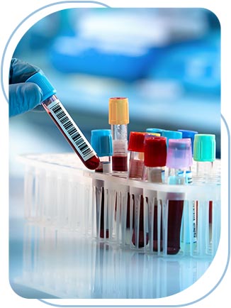Lab Services Urgent Care in Long Beach, Huntington Beach and Paramount, CA