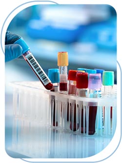 Lab Services Urgent Care in Long Beach, Huntington Beach and Paramount, CA