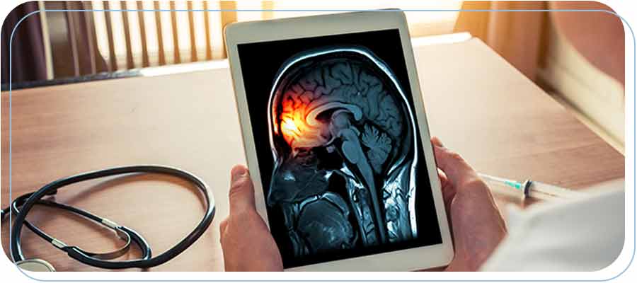 Migraine and Headache Treatment Near Me in Paramount Downtown Long Beach and Bixby Long Beach CA Migraine and Headache Treatment Near Me in Paramount Downtown Long Beach and Bixby Long Beach CA