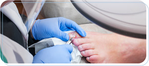Nail Injury Treatment Near Me in Paramount, CA Nail Injury Treatment Near Me in Paramount, CA
