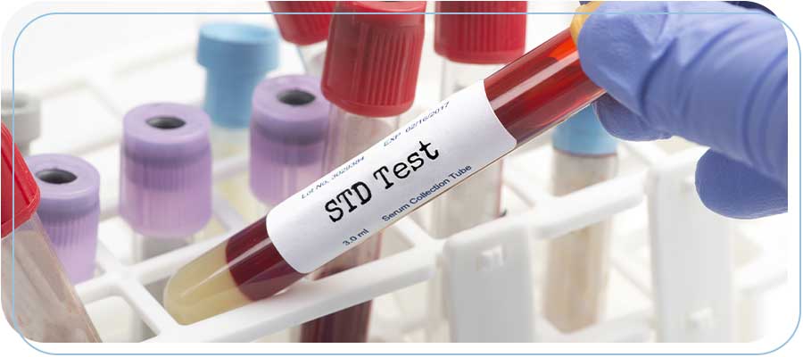 Confidential STD Testing Near Me in Downtown Long Beach, Bixby Knolls Long Beach, Paramount, CA Confidential STD Testing Near Me in Downtown Long Beach, Bixby Knolls Long Beach, Paramount, CA