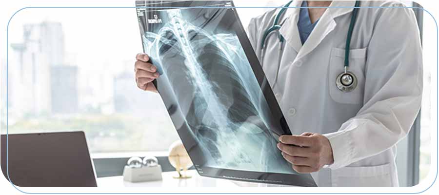Where to Get an X-Ray Near Me in Long Beach and Paramount CA Where to Get an X-Ray Near Me in Long Beach and Paramount CA