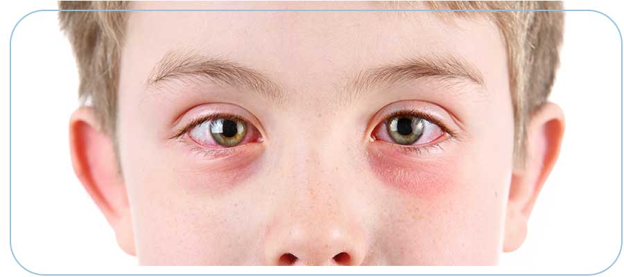 Pink Eye Treatment Near Me in Downtown Long Beach CA, Bixby Knolls Long Beach CA, and Paramount CA Pink Eye Treatment Near Me in Downtown Long Beach CA, Bixby Knolls Long Beach CA, and Paramount CA