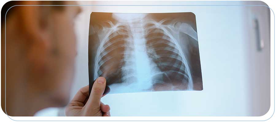 Urgent Care with X-Ray Near Me in Paramount CA Urgent Care with X-Ray Near Me in Paramount CA