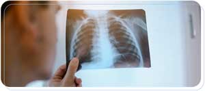 Urgent Care with X-Ray Near Me in Paramount CA Urgent Care with X-Ray Near Me in Paramount CA