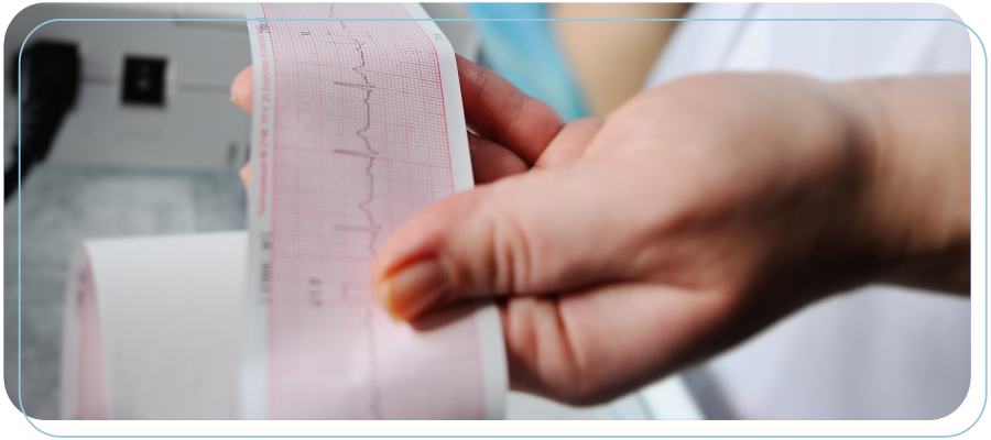Signs That You May Need An Electrocardiogram (EKG) Test Near Me in California Signs That You May Need An Electrocardiogram (EKG) Test Near Me in California