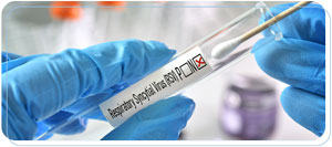 Fast RSV Testing and Treatment: Open 7 Days Near Me in Downtown Long Beach CA Fast RSV Testing and Treatment: Open 7 Days Near Me in Downtown Long Beach CA