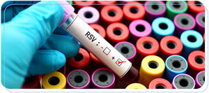 Rapid RSV Diagnosis for Children and Adults Near Me in Paramount CA Rapid RSV Diagnosis for Children and Adults Near Me in Paramount CA