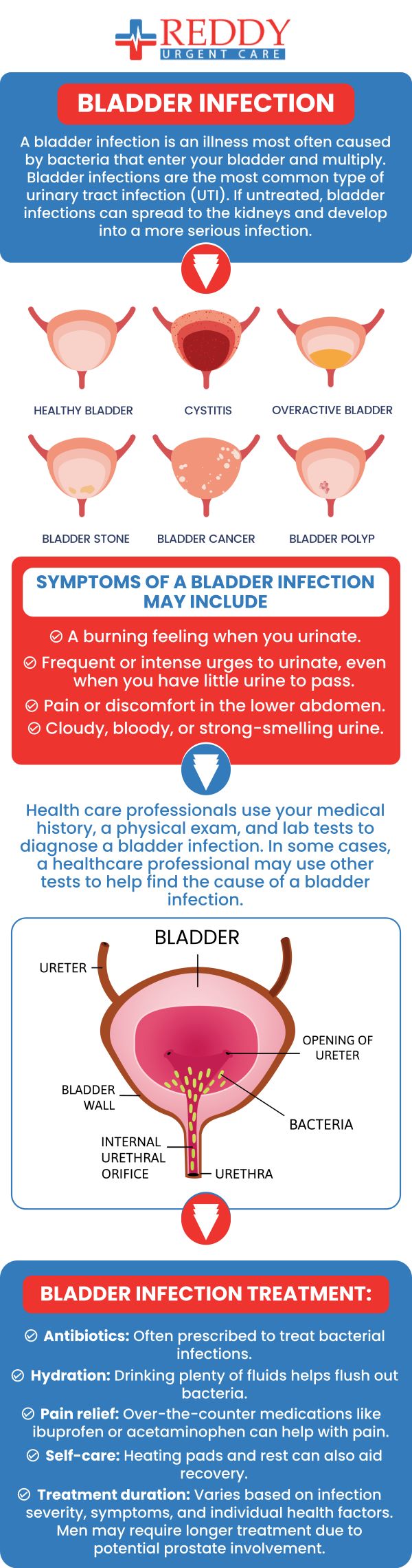 A bladder infection, or cystitis, is a common urinary tract infection that causes pain and a frequent urge to urinate. It's often caused by bacteria entering the urethra and can be easily treated with antibiotics. If left untreated, the infection can spread to the kidneys, leading to more serious health issues. Our team of medical professionals at Reddy Urgent Care clinics can help you if you are dealing with a bladder infection or other UTI. Contact us for all your urgent care needs or simply walk in. No appointments are necessary. We have convenient locations to serve you in Bixby Knolls Long Beach, Downtown Long Beach, and Paramount, CA. A bladder infection, or cystitis, is a common urinary tract infection that causes pain and a frequent urge to urinate. It's often caused by bacteria entering the urethra and can be easily treated with antibiotics. If left untreated, the infection can spread to the kidneys, leading to more serious health issues. Our team of medical professionals at Reddy Urgent Care clinics can help you if you are dealing with a bladder infection or other UTI. Contact us for all your urgent care needs or simply walk in. No appointments are necessary. We have convenient locations to serve you in Bixby Knolls Long Beach, Downtown Long Beach, and Paramount, CA.