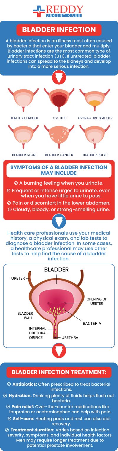 A bladder infection, or cystitis, is a common urinary tract infection that causes pain and a frequent urge to urinate. It's often caused by bacteria entering the urethra and can be easily treated with antibiotics. If left untreated, the infection can spread to the kidneys, leading to more serious health issues. Our team of medical professionals at Reddy Urgent Care clinics can help you if you are dealing with a bladder infection or other UTI. Contact us for all your urgent care needs or simply walk in. No appointments are necessary. We have convenient locations to serve you in Bixby Knolls Long Beach, Downtown Long Beach, and Paramount, CA. A bladder infection, or cystitis, is a common urinary tract infection that causes pain and a frequent urge to urinate. It's often caused by bacteria entering the urethra and can be easily treated with antibiotics. If left untreated, the infection can spread to the kidneys, leading to more serious health issues. Our team of medical professionals at Reddy Urgent Care clinics can help you if you are dealing with a bladder infection or other UTI. Contact us for all your urgent care needs or simply walk in. No appointments are necessary. We have convenient locations to serve you in Bixby Knolls Long Beach, Downtown Long Beach, and Paramount, CA.