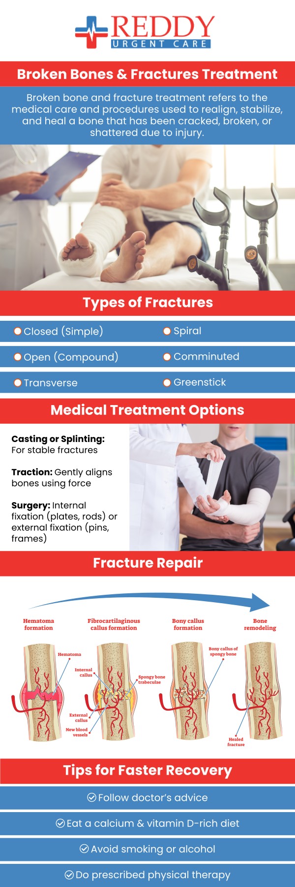 Don't let a fracture slow you down. Dr. Usha Rani K. Reddy, M.D., at Reddy Urgent Care provides prompt diagnosis and treatment for a variety of fractures, from hairline breaks to simple bone fractures. We offer on-site X-rays and have the expertise to stabilize your injury and create a plan for healing. Skip the long wait and get seen now. For more information, contact us. Walk-in visits are welcome. We have convenient locations to serve you in Bixby Knolls Long Beach, Downtown Long Beach, and Paramount, CA.