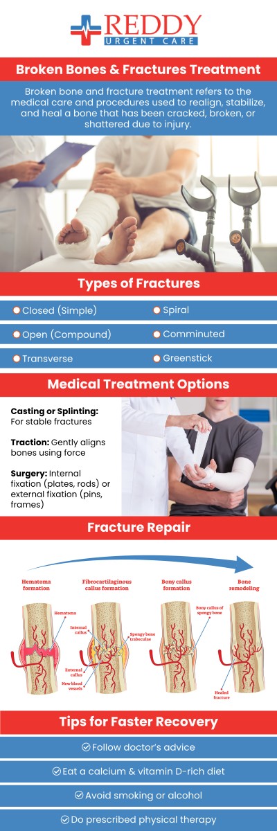 Don't let a fracture slow you down. Dr. Usha Rani K. Reddy, M.D., at Reddy Urgent Care provides prompt diagnosis and treatment for a variety of fractures, from hairline breaks to simple bone fractures. We offer on-site X-rays and have the expertise to stabilize your injury and create a plan for healing. Skip the long wait and get seen now. For more information, contact us. Walk-in visits are welcome. We have convenient locations to serve you in Bixby Knolls Long Beach, Downtown Long Beach, and Paramount, CA.