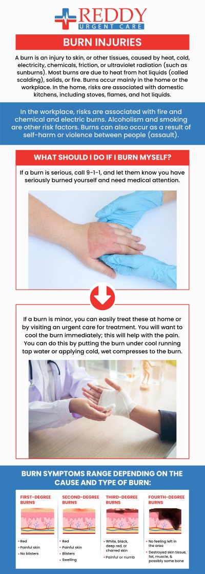 Burn injury is a type of tissue damage caused by heat, chemicals, electricity, sunlight, or radiation. These injuries are classified by depth, ranging from superficial first-degree burns affecting the outer skin layer to full thickness third degree burns that destroy all layers of skin and underlying tissue. For any first- or second-degree burn, Dr. Usha Rani K. Reddy, M.D., at Reddy Urgent Care can provide you with the highest quality of medical care. For more information, please contact us. We are located at 8311 Alondra Blvd, Paramount, CA 90723.