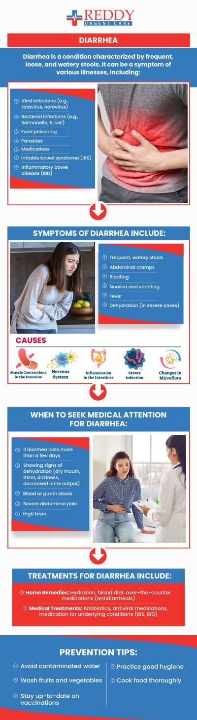 If you or a loved one is suffering from the discomfort of diarrhea and vomiting, come to Reddy Urgent Care to get relief today. Our physicians can develop a treatment plan that is right for you to help you get back to being you. Visit our team of healthcare professionals today. Contact us for all your urgent care needs or simply walk in. No appointments are necessary. We have convenient locations to serve you in Bixby Knolls Long Beach, Downtown Long Beach, and Paramount, CA.