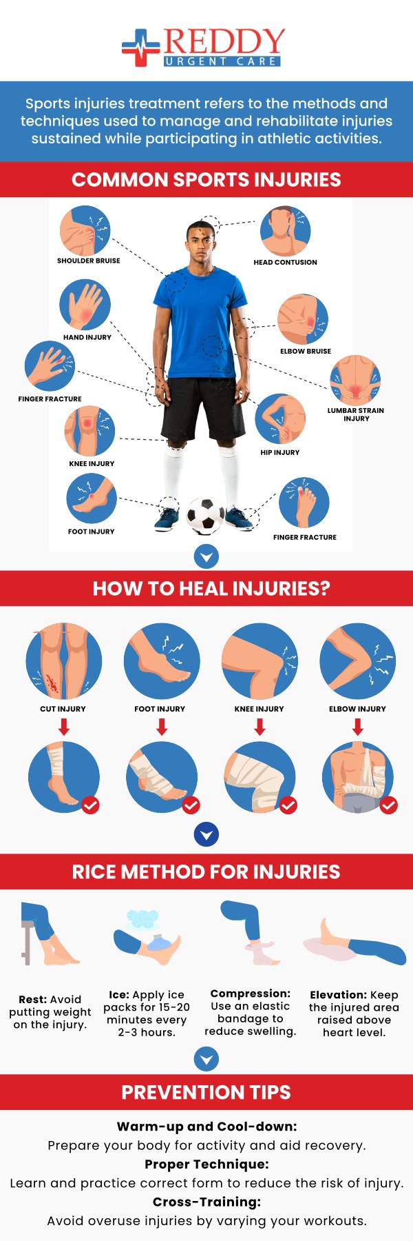 Reddy Urgent Care provides treatments for sports-related injuries such as sprains, bruises, tears, and broken bones. For more information call or visit us at one of our convenient locations in Bixby Knolls, Downtown Long Beach, and Paramount CA. Walk-ins are welcome!