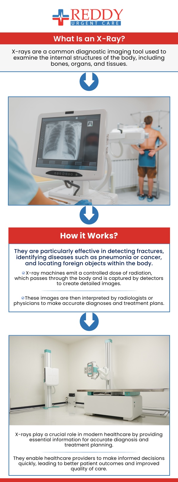 If you need urgent care with X-ray services, Dr. Usha Rani K. Reddy, M.D at Reddy Urgent Care provides quick and convenient access to imaging for diagnosing injuries such as fractures, sprains, or infections. X-rays provide rapid diagnoses and treatment, allowing you to skip the lengthy emergency room waits and get prompt care. For more information, contact us. We are located at 123 Atlantic Ave Long Beach, CA 90802.