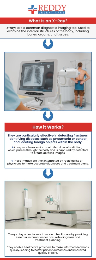 At Reddy Urgent Care, Dr. Usha Rani K. Reddy, M.D. Board Certified Physicians provide urgent care x-ray services to recognize different conditions, injuries, and problems. An X-ray is a type of body imaging that uses radiation to produce images of various internal body structures. X-ray is highly useful for detecting bone fractures, diagnosing swelling-related symptoms, looking at foreign items, and examining structural issues. If you need an X-ray come to our urgent clinic where no appointment is required We provide care for you as soon as possible. For more information, contact us. We are located at 4237 Atlantic Ave, Long Beach, CA 90807.
